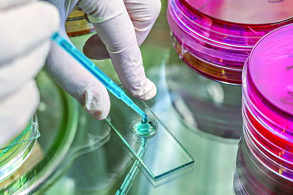 A ‘Nano4 Global’ deteta doenças como a tuberculose 