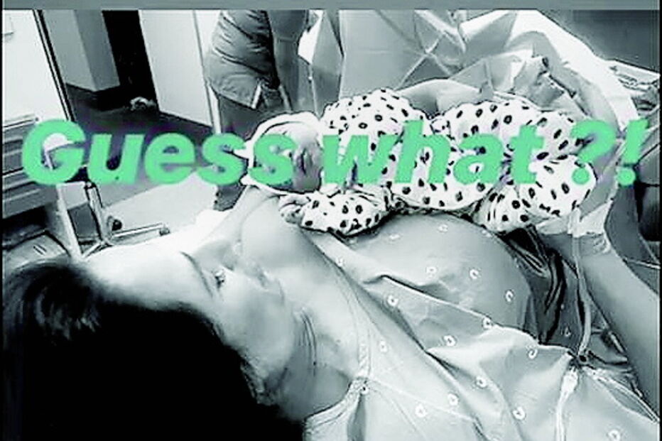 Um momento após o parto 