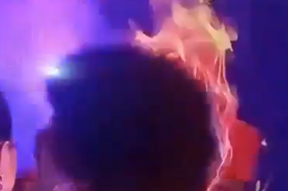 Cabelo da Miss África ardeu no momento da coroação	