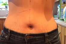 Fica entre a vida e a morte após ter sido 