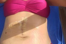 Fica entre a vida e a morte após ter sido 