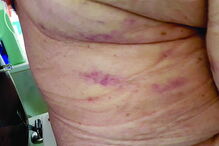 Dono de lar acusado de agredir idosos 