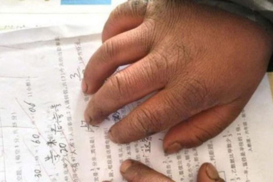 Menino do cabelo congelado já não precisa de andar 5 quilómetros para chegar à escola