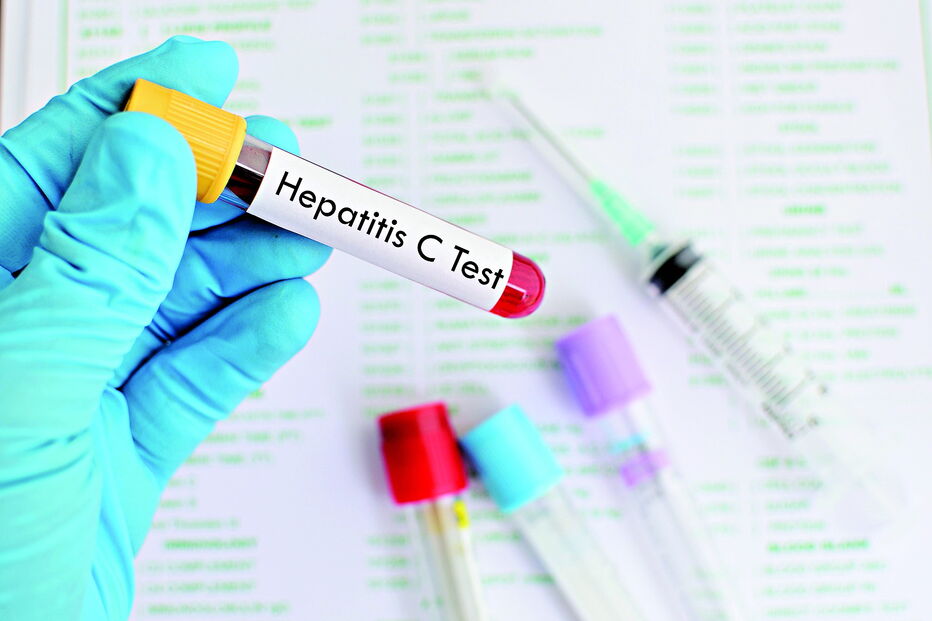 Teste para despistagem da hepatite C