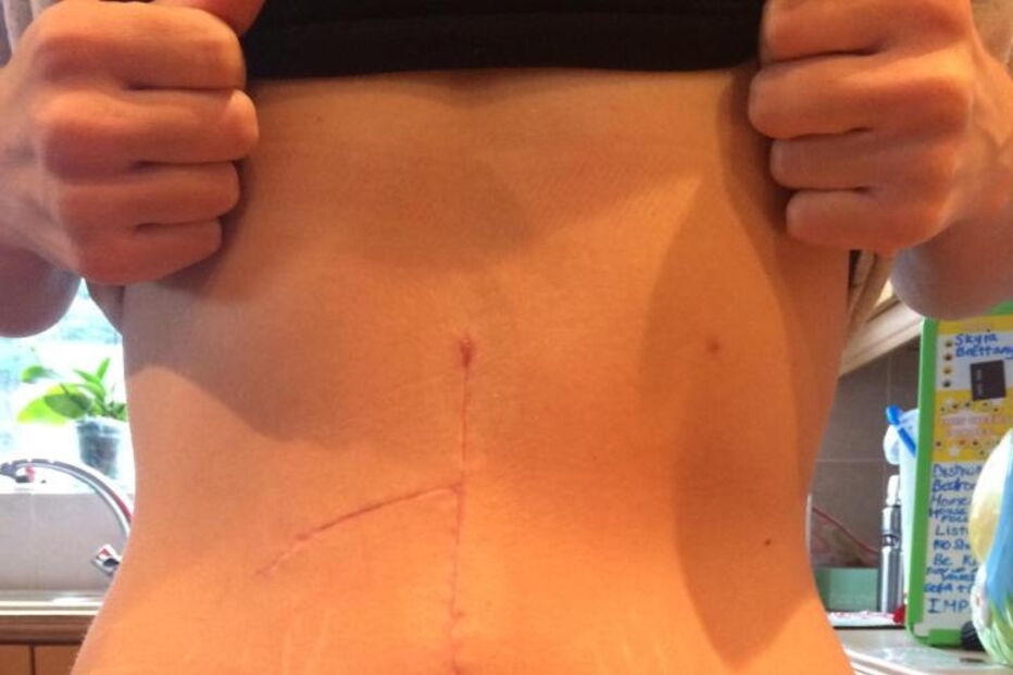 Fica entre a vida e a morte após ter sido 