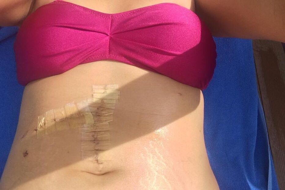 Fica entre a vida e a morte após ter sido 