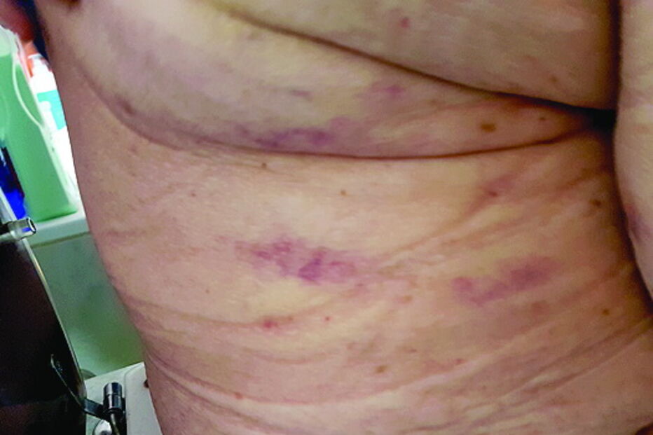 Dono de lar acusado de agredir idosos 