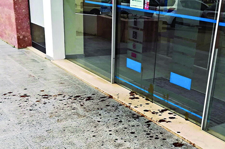 Finanças de Portimão atacadas com fezes