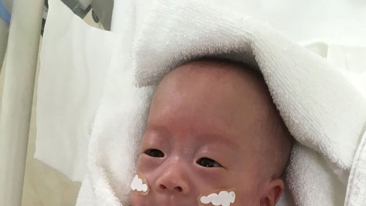 Bebe Que Nasceu Com 268 Gramas Ja Esta Em Casa Mundo Correio Da Manha