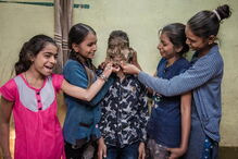 Lalit Patidar sofre de condição rara que lhe faz crescer pelos na cara