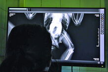 Raio-X detetou chumbo na cauda 