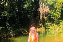 Mulher com 96% do corpo queimado após acidente de autocarro torna-se modelo