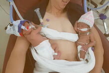 Gémeas prematuras separadas à nascença abraçam-se pela primeira vez