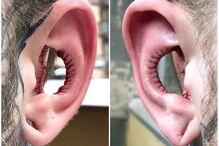 Cortar pedaço da orelha é a nova 'tendência' da Internet
