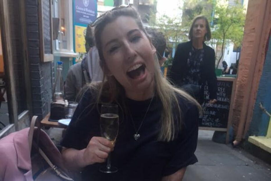 Mulher com 96% do corpo queimado após acidente de autocarro torna-se modelo