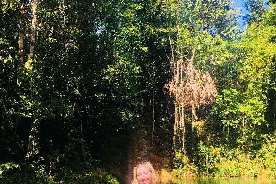 Mulher com 96% do corpo queimado após acidente de autocarro torna-se modelo