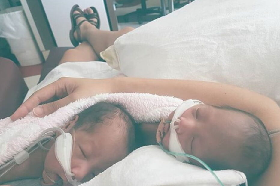 Gémeas prematuras separadas à nascença abraçam-se pela primeira vez