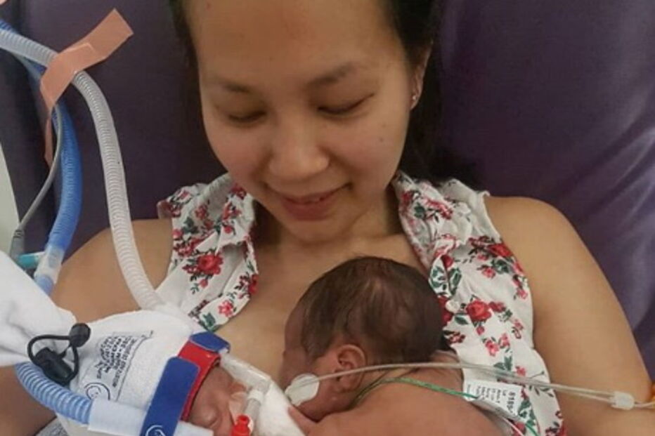 Gémeas prematuras separadas à nascença abraçam-se pela primeira vez