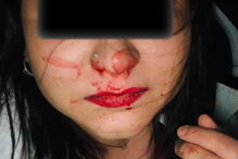 Jovens agredidas por motorista em Lisboa