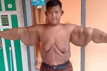 criança mais gorda do mundo