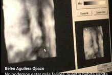 Imagens de ultrassom 3D partilhadas por grávidas enganadas