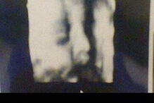 Imagens de ultrassom 3D partilhadas por grávidas enganadas