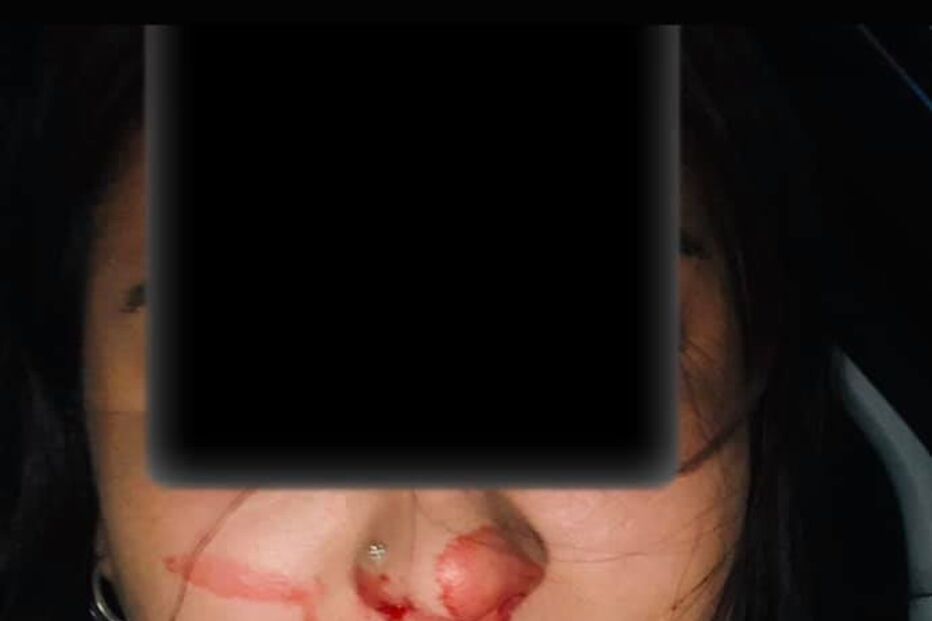 Jovens agredidas por motorista em Lisboa