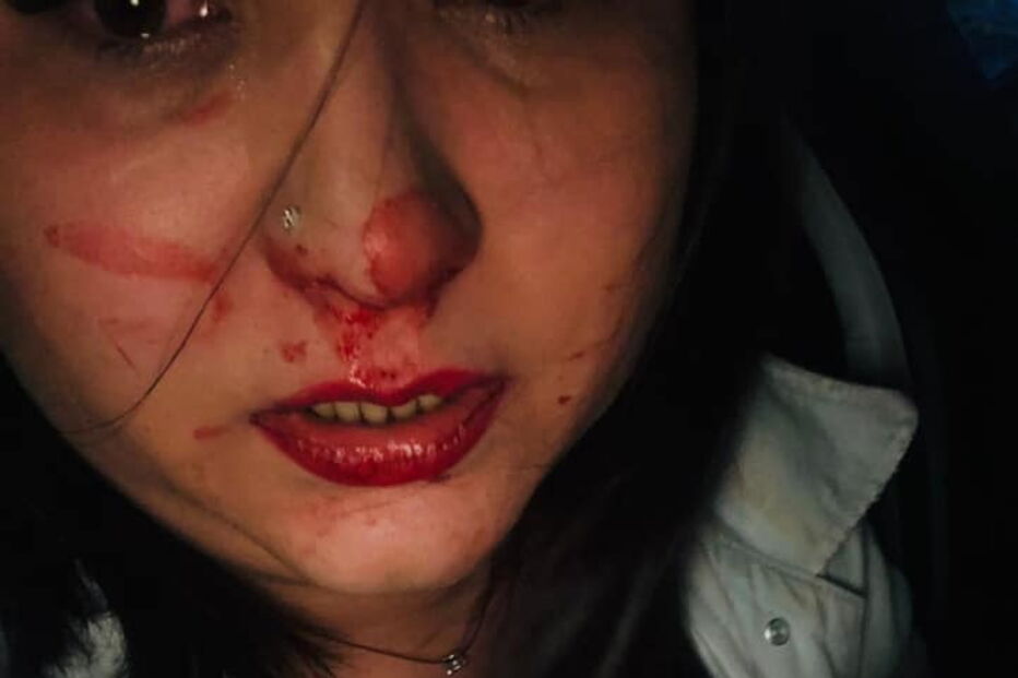 Jovens agredidas por motorista em Lisboa