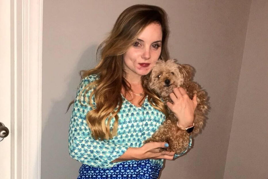 arranca lábio da ex-companheira com dentada para deixar marcas do fim do namoro