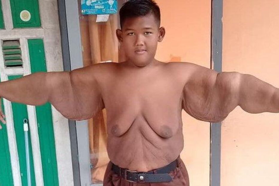 criança mais gorda do mundo