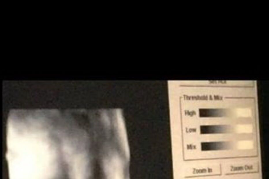 Imagens de ultrassom 3D partilhadas por grávidas enganadas