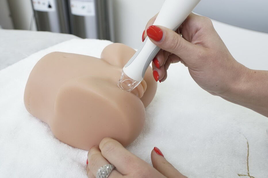 Técnica de rejuvenescimento vaginal 