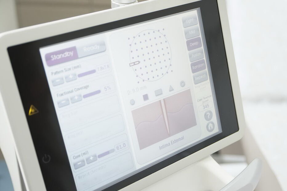 Técnica de rejuvenescimento vaginal 