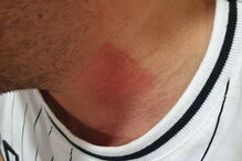 Detidos em Lisboa tiverem de recorrer a tratamento hospitalar