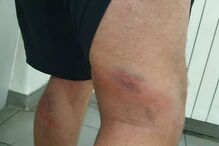 Detidos em Lisboa tiverem de recorrer a tratamento hospitalar