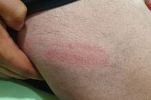 Detidos em Lisboa tiverem de recorrer a tratamento hospitalar