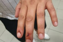 Detidos em Lisboa tiverem de recorrer a tratamento hospitalar