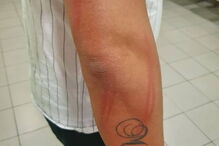 Detidos em Lisboa tiverem de recorrer a tratamento hospitalar