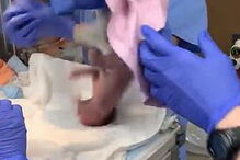 Vídeo mostra queda aparatosa de bebé prematura após lapso de médico