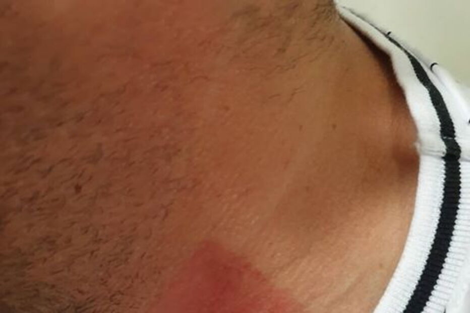 Detidos em Lisboa tiverem de recorrer a tratamento hospitalar