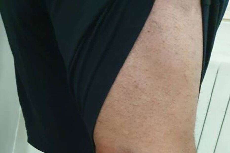 Detidos em Lisboa tiverem de recorrer a tratamento hospitalar