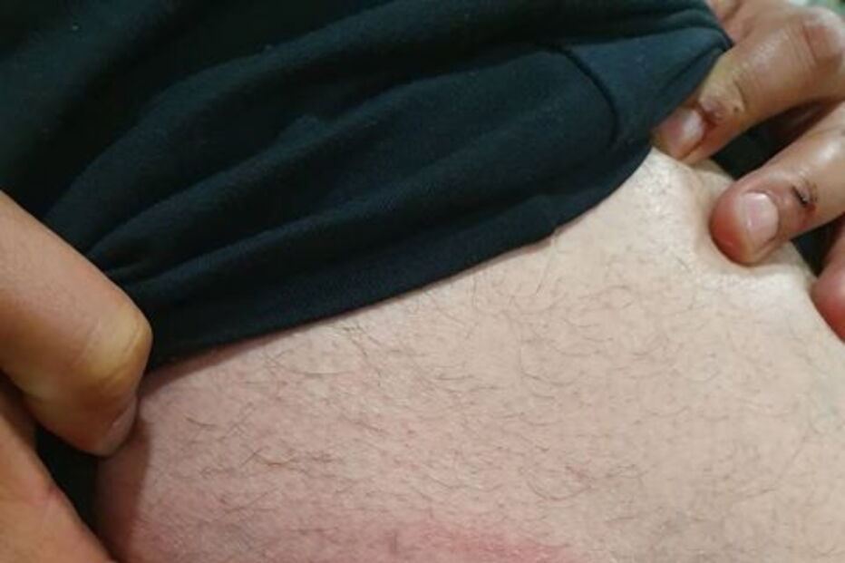 Detidos em Lisboa tiverem de recorrer a tratamento hospitalar