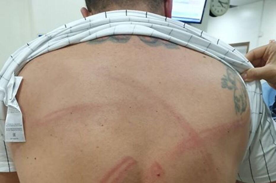 Detidos em Lisboa tiverem de recorrer a tratamento hospitalar