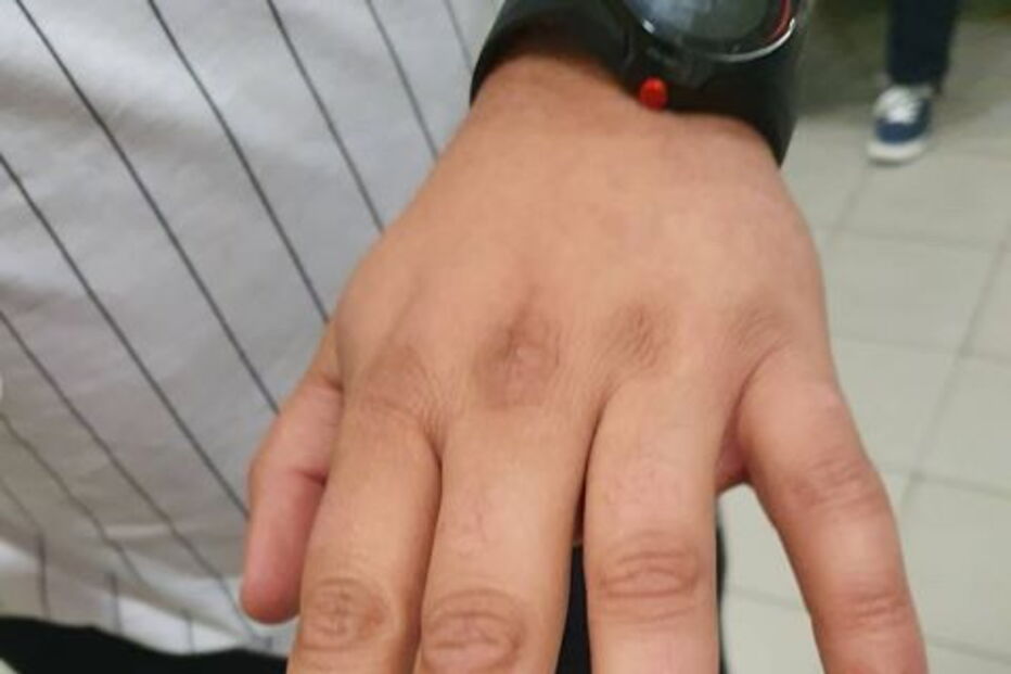 Detidos em Lisboa tiverem de recorrer a tratamento hospitalar