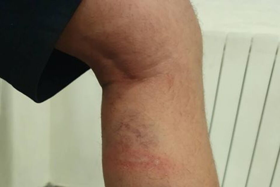 Detidos em Lisboa tiverem de recorrer a tratamento hospitalar