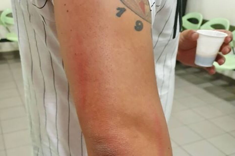 Detidos em Lisboa tiverem de recorrer a tratamento hospitalar