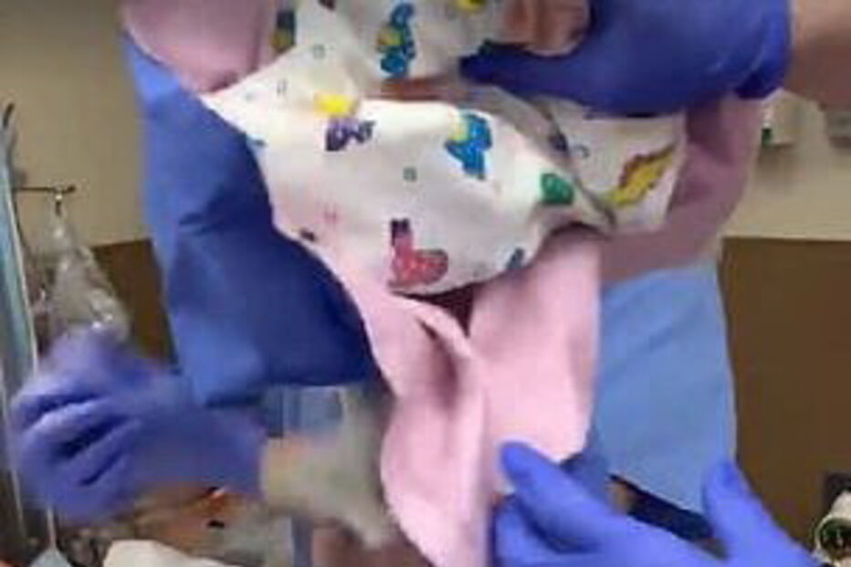 Vídeo mostra queda aparatosa de bebé prematura após lapso de médico