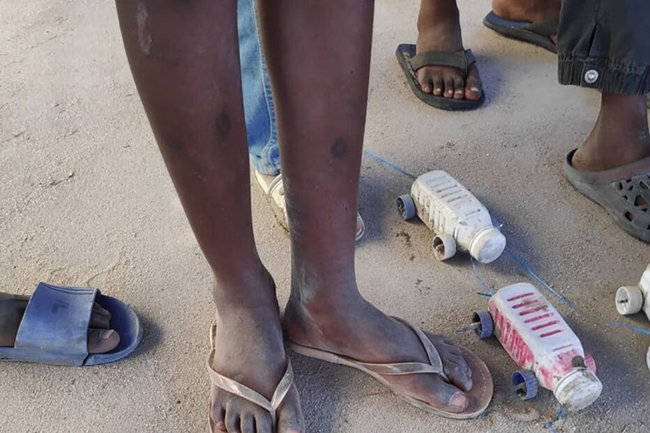 Sílvia Bentes partiu para Moçambique sem pensar duas vezes. Em casa deixou os filhos, um turismo rural e uma farmácia por gerir