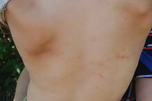 Criança de seis anos acorrentada 