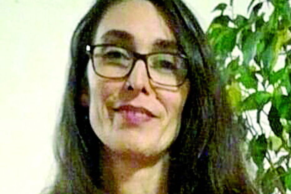 Sílvia Raposo sofreu queimaduras 